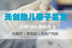 南京怀孕40天怎么做无创胎儿亲子鉴定,在南京哪些人群适合做无创胎儿亲子鉴定