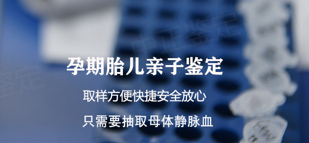 南京怀孕怎么做亲子鉴定,南京怀孕亲子鉴定办理流程