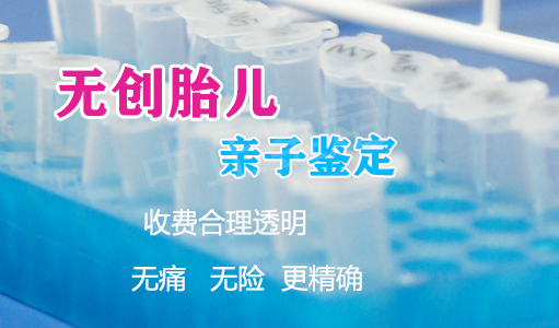 在[南京]刚怀孕需要怎么做DNA鉴定,南京怀孕亲子鉴定收费明细